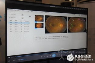 AI赋能眼科医疗 至真互联以网络技术研发推动行业革新